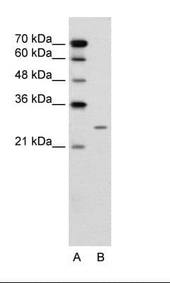 BPIFA1 / SPLUNC1 Antibody (aa101-150)