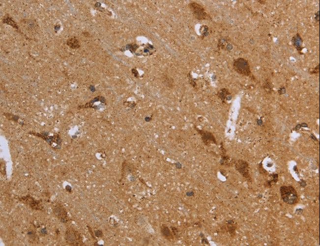 Polyclonal Rabbit anti-Human FH / Fumarase / MCL Antibody (IHC, WB)