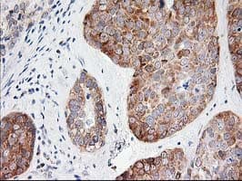 LCMT1 Antibody (clone OTI 1G5)
