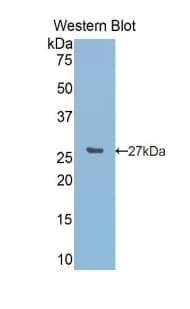 CA5A / Carbonic Anhydrase VA Antibody (aa12-219)