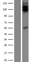 FGFR1 / FGF Receptor 1 Protein (Over-Expression Lysate Myc-DDK (Flag))
