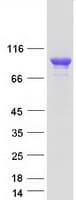 Human CTNNA3 / Alpha-3 Catenin Protein (Recombinant Myc-DDK (Flag))