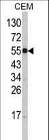 IHC-plus™ Polyclonal Rabbit anti-Human SLC11A1 / NRAMP Antibody (aa250-276, IHC, IF, WB)