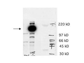 IHC-plus™ CASZ1 Antibody