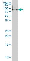 Monoclonal Mouse anti-Human FMR1 / FMRP Antibody (clone 2D4, WB)