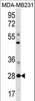 SPIB Antibody (aa216-245)