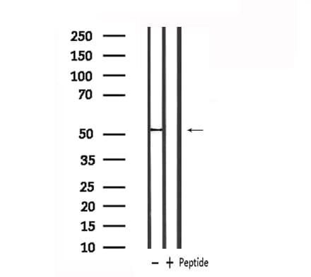 NAMPT / Visfatin Antibody
