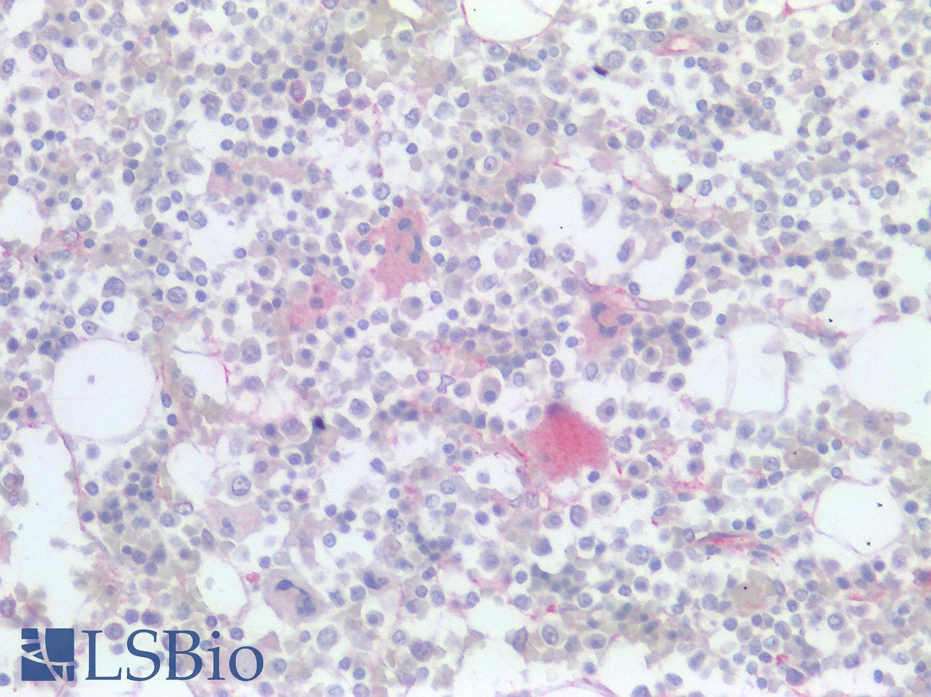 PathPlus™ Polyclonal Rabbit anti-Human CD36 Antibody (IHC, WB)