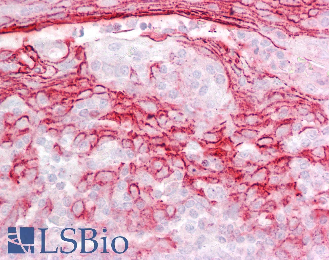 IHC-plus™ IGFBP7 / TAF Antibody (aa194-207)