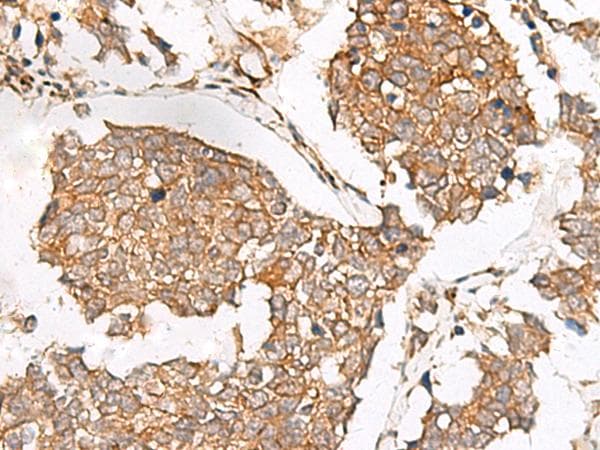 SLC40A1 / Ferroportin-1 Antibody