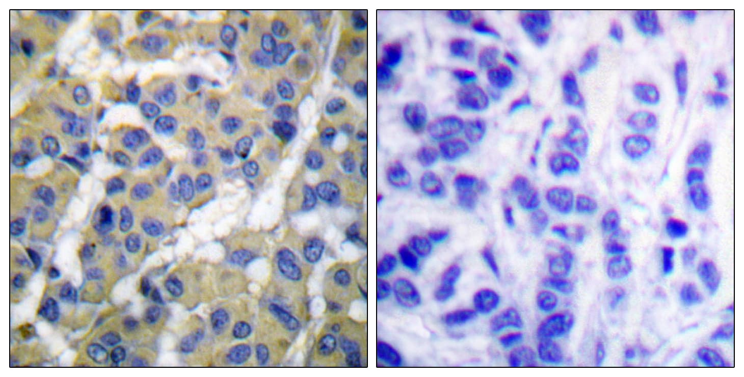 KRT8 / CK8 / Cytokeratin 8 Antibody (phospho-Ser73)