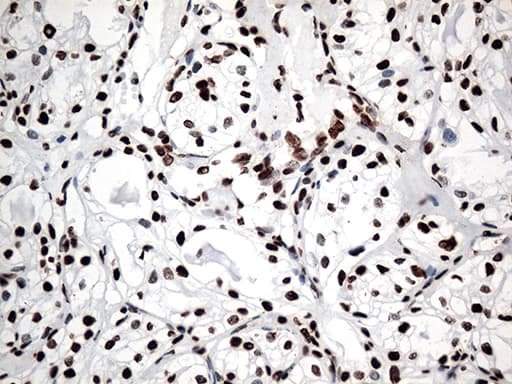 Monoclonal Mouse anti-Human KARS Antibody (clone OTI1E7, IHC, WB)