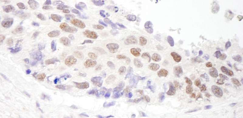 HDAC3 Antibody (aa375-C-term)