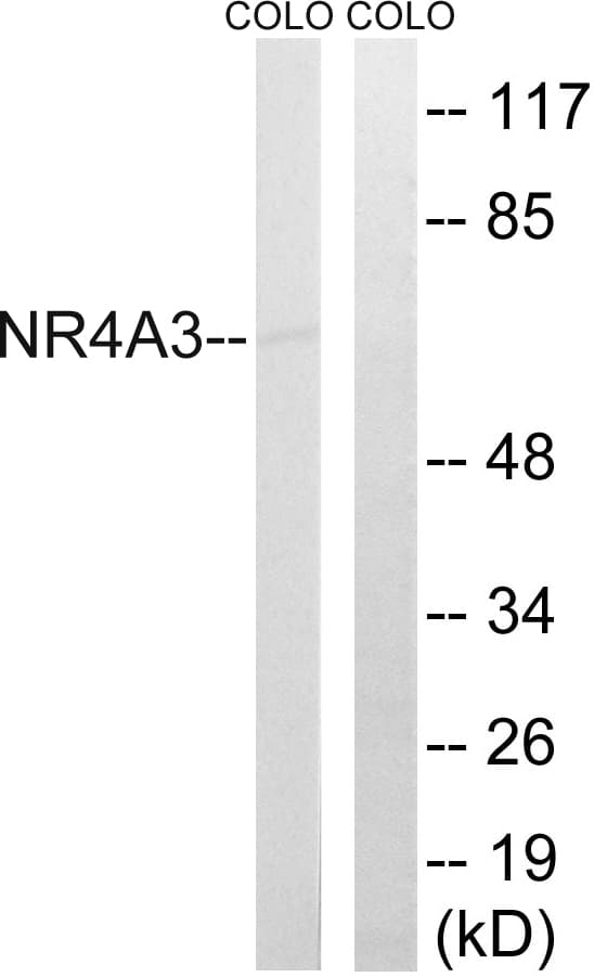 Nor-1 / NR4A3 Antibody (aa387-436)