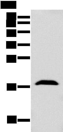 GMF Beta / GMFB Antibody