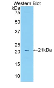 SERPING1 / C1 Inhibitor Antibody (aa35-179, APC)