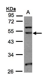 NSUN6 Antibody (aa179-469)
