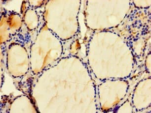 Polyclonal Rabbit anti-Human ZMAT4 Antibody