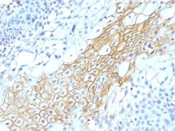 CD59 Antibody (clone MACIF/1193)