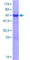 Human TBC1D21 Protein (Recombinant GST)