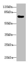 CBFA2T2 / MTGR1 Antibody