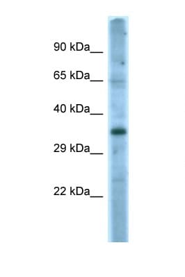 Polyclonal Rabbit anti-Human FASLG / Fas Ligand Antibody (aa121-170, WB)