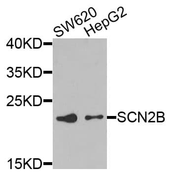 IHC-plus™ SCN2B Antibody