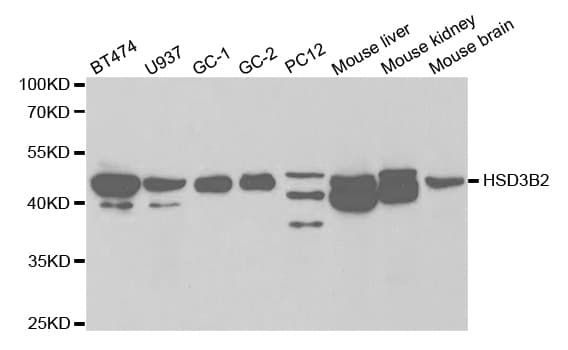 HSD3B2 Antibody