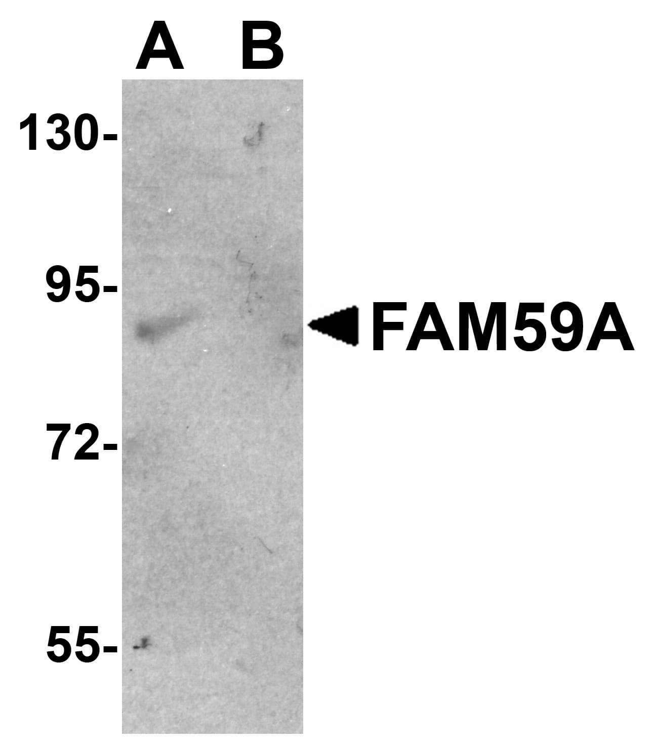 IHC-plus™ GAREM / FAM59A Antibody
