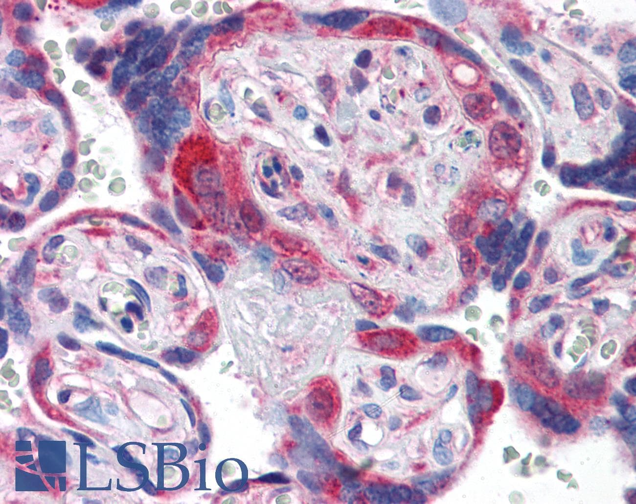 IHC-plus™ PDGFRA / PDGFR Alpha Antibody (C-Terminus)