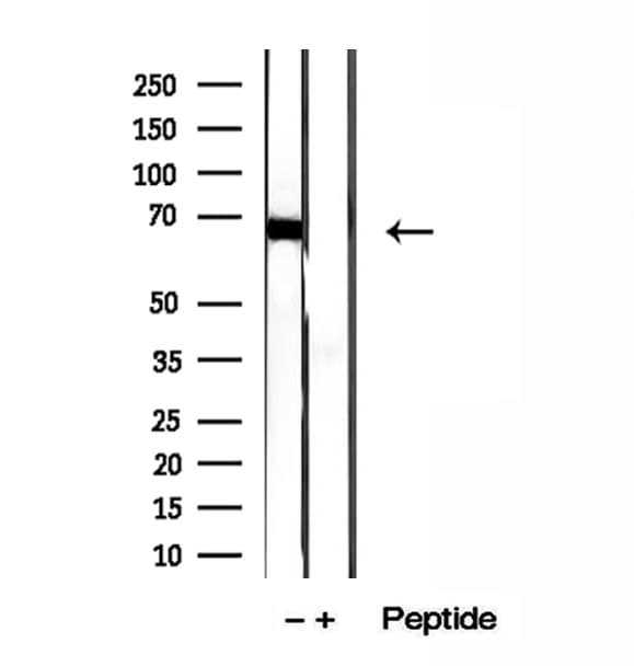 ADAM12 Antibody