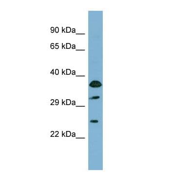 ABCC5 / MRP5 Antibody (aa131-180)