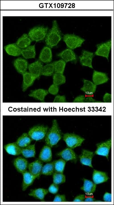 Polyclonal Rabbit anti-Human SUCLA2 Antibody (aa138-416, IHC, WB)