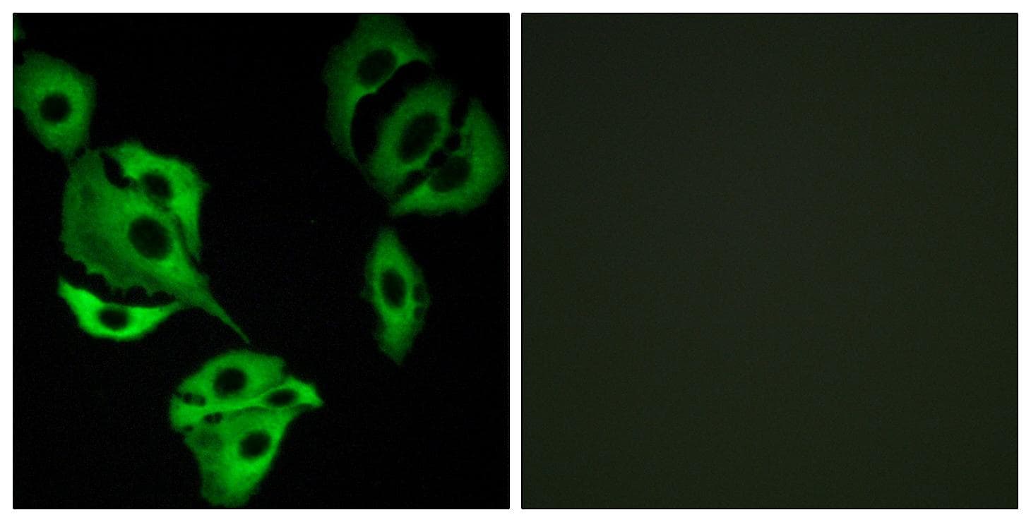 ADCK4 Antibody