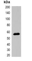 MBP Tag Antibody