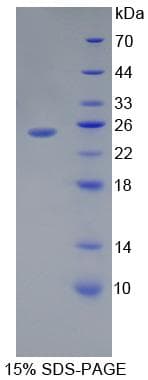 Human TLR5 Protein (Recombinant His)