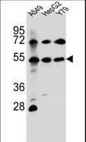 FGFRL1 Antibody (aa131-160)