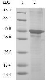 Human CIRP / CIRBP Protein (Recombinant GST, N-terminus)