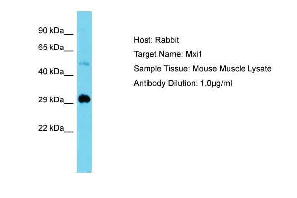 Polyclonal Rabbit anti-Mouse MXI1 / MAD2 Antibody (N-Terminus, IHC, WB)