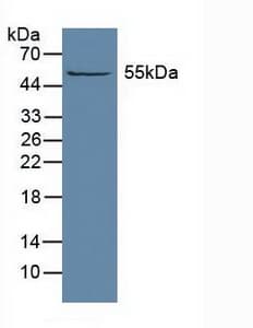 ALDH1A1 / ALDH1 Antibody (aa2-501)