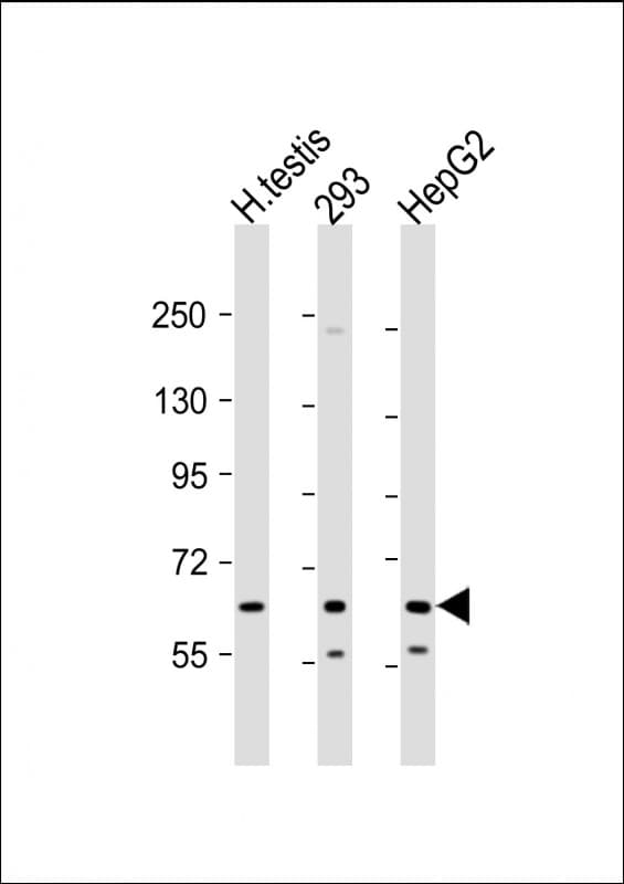 Polyclonal Rabbit anti-Human KL / Klotho Antibody (C-Terminus, WB)