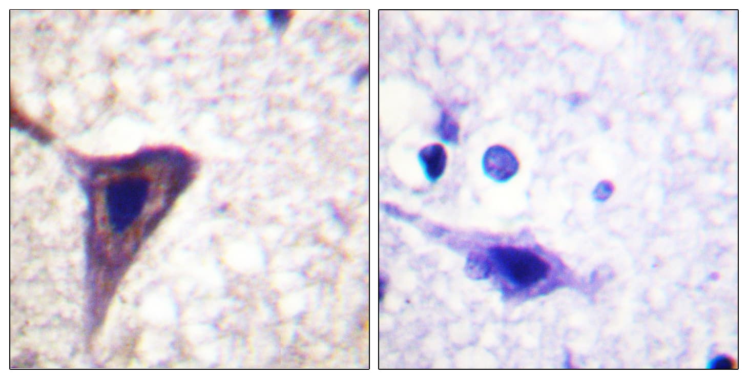 BID Antibody (phospho-Ser78)
