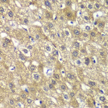 Polyclonal Rabbit anti-Human MYBPC2 Antibody (IHC, WB)
