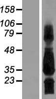 SCN4B Protein (Over-Expression Lysate Myc-DDK (Flag))