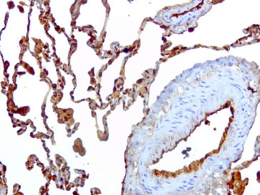 Monoclonal Mouse anti-Human S100A9 / MRP14 Antibody (clone UMAB174, IHC, WB)