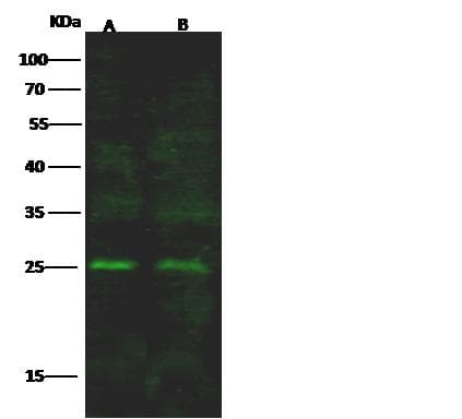 Polyclonal Rabbit anti-Human GSTP1 / GST Pi Antibody (Preservative Free, IF, WB)