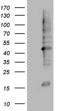 MTOR Antibody (aa1766-2144, clone OTI1D5)