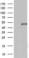 KRT20 / CK20 / Cytokeratin 20 Antibody (clone OTI2H9)