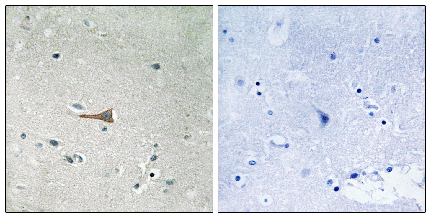 NEP / DDR1 Antibody (phospho-Tyr513)