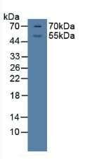 NR3C1/Glucocorticoid Receptor Antibody
